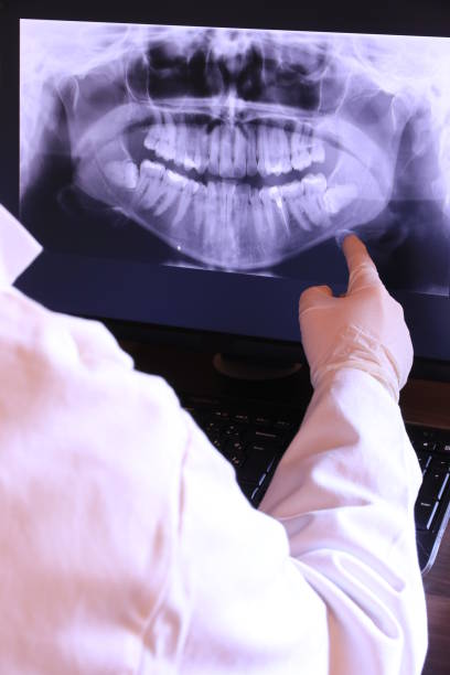 Emergency Dentist for Kids in NJ